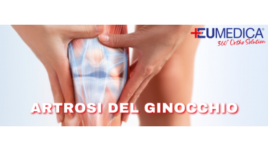 Il ginocchio e l'artrosi